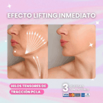 Hilos-de-Traccion-PCLA