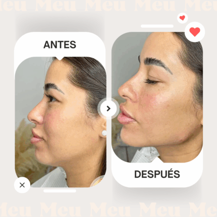 {"type":"elementor","siteurl":"https://clinicameu.cl/wp-json/","elements":[{"id":"a79129c","elType":"widget","isInner":false,"isLocked":false,"settings":{"extra_width_classes":"wd-width-100","ids":[],"ids_size":"large","ids_custom_dimension":{"width":"","height":""},"on_click":"lightbox","target_blank":"0","caption":"0","custom_links":"","lazy_loading":"no","view":"grid","spacing":"0","spacing_tablet":"","spacing_mobile":"","columns":{"unit":"px","size":3,"sizes":[]},"columns_tablet":{"unit":"px","size":"","sizes":[]},"columns_mobile":{"unit":"px","size":"","sizes":[]},"rounding_size":"","custom_rounding_size":{"unit":"px","size":"","sizes":[]},"horizontal_align":"center","vertical_align":"middle","slides_per_view":{"unit":"px","size":3,"sizes":[]},"slides_per_view_tablet":{"unit":"px","size":"","sizes":[]},"slides_per_view_mobile":{"unit":"px","size":"","sizes":[]},"scroll_per_page":"yes","center_mode":"no","wrap":"no","autoheight":"no","autoplay":"no","speed":"5000","scroll_carousel_init":"no","disable_overflow_carousel":"no","hide_prev_next_buttons":"no","carousel_arrows_position_popover":"","carousel_arrows_position":"","carousel_arrows_offset_h":{"unit":"px","size":"","sizes":[]},"carousel_arrows_offset_h_tablet":{"unit":"px","size":"","sizes":[]},"carousel_arrows_offset_h_mobile":{"unit":"px","size":"","sizes":[]},"carousel_arrows_offset_v":{"unit":"px","size":"","sizes":[]},"carousel_arrows_offset_v_tablet":{"unit":"px","size":"","sizes":[]},"carousel_arrows_offset_v_mobile":{"unit":"px","size":"","sizes":[]},"hide_pagination_control":"no","hide_pagination_control_tablet":"yes","hide_pagination_control_mobile":"yes","dynamic_pagination_control":"no","hide_scrollbar":"yes","hide_scrollbar_tablet":"yes","hide_scrollbar_mobile":"yes","carousel_sync":"","sync_parent_id":"wd_6848993babfb8","sync_child_id":"","_title":"","_margin":{"unit":"px","top":"","right":"","bottom":"","left":"","isLinked":true},"_margin_tablet":{"unit":"px","top":"","right":"","bottom":"","left":"","isLinked":true},"_margin_mobile":{"unit":"px","top":"","right":"","bottom":"","left":"","isLinked":true},"_padding":{"unit":"px","top":"","right":"","bottom":"","left":"","isLinked":true},"_padding_tablet":{"unit":"px","top":"","right":"","bottom":"","left":"","isLinked":true},"_padding_mobile":{"unit":"px","top":"","right":"","bottom":"","left":"","isLinked":true},"_element_width":"","_element_width_tablet":"","_element_width_mobile":"","_element_custom_width":{"unit":"%","size":"","sizes":[]},"_element_custom_width_tablet":{"unit":"px","size":"","sizes":[]},"_element_custom_width_mobile":{"unit":"px","size":"","sizes":[]},"_grid_column":"","_grid_column_tablet":"","_grid_column_mobile":"","_grid_column_custom":"","_grid_column_custom_tablet":"","_grid_column_custom_mobile":"","_grid_row":"","_grid_row_tablet":"","_grid_row_mobile":"","_grid_row_custom":"","_grid_row_custom_tablet":"","_grid_row_custom_mobile":"","_element_vertical_align":"","_element_vertical_align_tablet":"","_element_vertical_align_mobile":"","_position":"","_offset_orientation_h":"start","_offset_x":{"unit":"px","size":0,"sizes":[]},"_offset_x_tablet":{"unit":"px","size":"","sizes":[]},"_offset_x_mobile":{"unit":"px","size":"","sizes":[]},"_offset_x_end":{"unit":"px","size":0,"sizes":[]},"_offset_x_end_tablet":{"unit":"px","size":"","sizes":[]},"_offset_x_end_mobile":{"unit":"px","size":"","sizes":[]},"_offset_orientation_v":"start","_offset_y":{"unit":"px","size":0,"sizes":[]},"_offset_y_tablet":{"unit":"px","size":"","sizes":[]},"_offset_y_mobile":{"unit":"px","size":"","sizes":[]},"_offset_y_end":{"unit":"px","size":0,"sizes":[]},"_offset_y_end_tablet":{"unit":"px","size":"","sizes":[]},"_offset_y_end_mobile":{"unit":"px","size":"","sizes":[]},"_z_index":"","_z_index_tablet":"","_z_index_mobile":"","_element_id":"","_css_classes":"","element_parallax":"","scroll_x":0,"scroll_y":-80,"scroll_z":0,"scroll_smoothness":"30","wd_animation":"","wd_animation_duration":"normal","wd_animation_delay":100,"_animation":"","_animation_tablet":"","_animation_mobile":"","animation_duration":"","_animation_delay":"","_transform_rotate_popover":"","_transform_rotateZ_effect":{"unit":"px","size":"","sizes":[]},"_transform_rotateZ_effect_tablet":{"unit":"deg","size":"","sizes":[]},"_transform_rotateZ_effect_mobile":{"unit":"deg","size":"","sizes":[]},"_transform_rotate_3d":"","_transform_rotateX_effect":{"unit":"px","size":"","sizes":[]},"_transform_rotateX_effect_tablet":{"unit":"deg","size":"","sizes":[]},"_transform_rotateX_effect_mobile":{"unit":"deg","size":"","sizes":[]},"_transform_rotateY_effect":{"unit":"px","size":"","sizes":[]},"_transform_rotateY_effect_tablet":{"unit":"deg","size":"","sizes":[]},"_transform_rotateY_effect_mobile":{"unit":"deg","size":"","sizes":[]},"_transform_perspective_effect":{"unit":"px","size":"","sizes":[]},"_transform_perspective_effect_tablet":{"unit":"px","size":"","sizes":[]},"_transform_perspective_effect_mobile":{"unit":"px","size":"","sizes":[]},"_transform_translate_popover":"","_transform_translateX_effect":{"unit":"px","size":"","sizes":[]},"_transform_translateX_effect_tablet":{"unit":"px","size":"","sizes":[]},"_transform_translateX_effect_mobile":{"unit":"px","size":"","sizes":[]},"_transform_translateY_effect":{"unit":"px","size":"","sizes":[]},"_transform_translateY_effect_tablet":{"unit":"px","size":"","sizes":[]},"_transform_translateY_effect_mobile":{"unit":"px","size":"","sizes":[]},"_transform_scale_popover":"","_transform_keep_proportions":"yes","_transform_scale_effect":{"unit":"px","size":"","sizes":[]},"_transform_scale_effect_tablet":{"unit":"px","size":"","sizes":[]},"_transform_scale_effect_mobile":{"unit":"px","size":"","sizes":[]},"_transform_scaleX_effect":{"unit":"px","size":"","sizes":[]},"_transform_scaleX_effect_tablet":{"unit":"px","size":"","sizes":[]},"_transform_scaleX_effect_mobile":{"unit":"px","size":"","sizes":[]},"_transform_scaleY_effect":{"unit":"px","size":"","sizes":[]},"_transform_scaleY_effect_tablet":{"unit":"px","size":"","sizes":[]},"_transform_scaleY_effect_mobile":{"unit":"px","size":"","sizes":[]},"_transform_skew_popover":"","_transform_skewX_effect":{"unit":"px","size":"","sizes":[]},"_transform_skewX_effect_tablet":{"unit":"deg","size":"","sizes":[]},"_transform_skewX_effect_mobile":{"unit":"deg","size":"","sizes":[]},"_transform_skewY_effect":{"unit":"px","size":"","sizes":[]},"_transform_skewY_effect_tablet":{"unit":"deg","size":"","sizes":[]},"_transform_skewY_effect_mobile":{"unit":"deg","size":"","sizes":[]},"_transform_flipX_effect":"","_transform_flipY_effect":"","_transform_rotate_popover_hover":"","_transform_rotateZ_effect_hover":{"unit":"px","size":"","sizes":[]},"_transform_rotateZ_effect_hover_tablet":{"unit":"deg","size":"","sizes":[]},"_transform_rotateZ_effect_hover_mobile":{"unit":"deg","size":"","sizes":[]},"_transform_rotate_3d_hover":"","_transform_rotateX_effect_hover":{"unit":"px","size":"","sizes":[]},"_transform_rotateX_effect_hover_tablet":{"unit":"deg","size":"","sizes":[]},"_transform_rotateX_effect_hover_mobile":{"unit":"deg","size":"","sizes":[]},"_transform_rotateY_effect_hover":{"unit":"px","size":"","sizes":[]},"_transform_rotateY_effect_hover_tablet":{"unit":"deg","size":"","sizes":[]},"_transform_rotateY_effect_hover_mobile":{"unit":"deg","size":"","sizes":[]},"_transform_perspective_effect_hover":{"unit":"px","size":"","sizes":[]},"_transform_perspective_effect_hover_tablet":{"unit":"px","size":"","sizes":[]},"_transform_perspective_effect_hover_mobile":{"unit":"px","size":"","sizes":[]},"_transform_translate_popover_hover":"","_transform_translateX_effect_hover":{"unit":"px","size":"","sizes":[]},"_transform_translateX_effect_hover_tablet":{"unit":"px","size":"","sizes":[]},"_transform_translateX_effect_hover_mobile":{"unit":"px","size":"","sizes":[]},"_transform_translateY_effect_hover":{"unit":"px","size":"","sizes":[]},"_transform_translateY_effect_hover_tablet":{"unit":"px","size":"","sizes":[]},"_transform_translateY_effect_hover_mobile":{"unit":"px","size":"","sizes":[]},"_transform_scale_popover_hover":"","_transform_keep_proportions_hover":"yes","_transform_scale_effect_hover":{"unit":"px","size":"","sizes":[]},"_transform_scale_effect_hover_tablet":{"unit":"px","size":"","sizes":[]},"_transform_scale_effect_hover_mobile":{"unit":"px","size":"","sizes":[]},"_transform_scaleX_effect_hover":{"unit":"px","size":"","sizes":[]},"_transform_scaleX_effect_hover_tablet":{"unit":"px","size":"","sizes":[]},"_transform_scaleX_effect_hover_mobile":{"unit":"px","size":"","sizes":[]},"_transform_scaleY_effect_hover":{"unit":"px","size":"","sizes":[]},"_transform_scaleY_effect_hover_tablet":{"unit":"px","size":"","sizes":[]},"_transform_scaleY_effect_hover_mobile":{"unit":"px","size":"","sizes":[]},"_transform_skew_popover_hover":"","_transform_skewX_effect_hover":{"unit":"px","size":"","sizes":[]},"_transform_skewX_effect_hover_tablet":{"unit":"deg","size":"","sizes":[]},"_transform_skewX_effect_hover_mobile":{"unit":"deg","size":"","sizes":[]},"_transform_skewY_effect_hover":{"unit":"px","size":"","sizes":[]},"_transform_skewY_effect_hover_tablet":{"unit":"deg","size":"","sizes":[]},"_transform_skewY_effect_hover_mobile":{"unit":"deg","size":"","sizes":[]},"_transform_flipX_effect_hover":"","_transform_flipY_effect_hover":"","_transform_transition_hover":{"unit":"px","size":"","sizes":[]},"motion_fx_transform_x_anchor_point":"","motion_fx_transform_x_anchor_point_tablet":"","motion_fx_transform_x_anchor_point_mobile":"","motion_fx_transform_y_anchor_point":"","motion_fx_transform_y_anchor_point_tablet":"","motion_fx_transform_y_anchor_point_mobile":"","_background_background":"","_background_color":"","_background_color_stop":{"unit":"%","size":0,"sizes":[]},"_background_color_stop_tablet":{"unit":"%"},"_background_color_stop_mobile":{"unit":"%"},"_background_color_b":"#f2295b","_background_color_b_stop":{"unit":"%","size":100,"sizes":[]},"_background_color_b_stop_tablet":{"unit":"%"},"_background_color_b_stop_mobile":{"unit":"%"},"_background_gradient_type":"linear","_background_gradient_angle":{"unit":"deg","size":180,"sizes":[]},"_background_gradient_angle_tablet":{"unit":"deg"},"_background_gradient_angle_mobile":{"unit":"deg"},"_background_gradient_position":"center center","_background_gradient_position_tablet":"","_background_gradient_position_mobile":"","_background_image":{"url":"","id":"","size":""},"_background_image_tablet":{"url":"","id":"","size":""},"_background_image_mobile":{"url":"","id":"","size":""},"_background_position":"","_background_position_tablet":"","_background_position_mobile":"","_background_xpos":{"unit":"px","size":0,"sizes":[]},"_background_xpos_tablet":{"unit":"px","size":0,"sizes":[]},"_background_xpos_mobile":{"unit":"px","size":0,"sizes":[]},"_background_ypos":{"unit":"px","size":0,"sizes":[]},"_background_ypos_tablet":{"unit":"px","size":0,"sizes":[]},"_background_ypos_mobile":{"unit":"px","size":0,"sizes":[]},"_background_attachment":"","_background_repeat":"","_background_repeat_tablet":"","_background_repeat_mobile":"","_background_size":"","_background_size_tablet":"","_background_size_mobile":"","_background_bg_width":{"unit":"%","size":100,"sizes":[]},"_background_bg_width_tablet":{"unit":"px","size":"","sizes":[]},"_background_bg_width_mobile":{"unit":"px","size":"","sizes":[]},"_background_video_link":"","_background_video_start":"","_background_video_end":"","_background_play_once":"","_background_play_on_mobile":"","_background_privacy_mode":"","_background_video_fallback":{"url":"","id":"","size":""},"_background_slideshow_gallery":[],"_background_slideshow_loop":"yes","_background_slideshow_slide_duration":5000,"_background_slideshow_slide_transition":"fade","_background_slideshow_transition_duration":500,"_background_slideshow_background_size":"","_background_slideshow_background_size_tablet":"","_background_slideshow_background_size_mobile":"","_background_slideshow_background_position":"","_background_slideshow_background_position_tablet":"","_background_slideshow_background_position_mobile":"","_background_slideshow_lazyload":"","_background_slideshow_ken_burns":"","_background_slideshow_ken_burns_zoom_direction":"in","_background_hover_background":"","_background_hover_color":"","_background_hover_color_stop":{"unit":"%","size":0,"sizes":[]},"_background_hover_color_stop_tablet":{"unit":"%"},"_background_hover_color_stop_mobile":{"unit":"%"},"_background_hover_color_b":"#f2295b","_background_hover_color_b_stop":{"unit":"%","size":100,"sizes":[]},"_background_hover_color_b_stop_tablet":{"unit":"%"},"_background_hover_color_b_stop_mobile":{"unit":"%"},"_background_hover_gradient_type":"linear","_background_hover_gradient_angle":{"unit":"deg","size":180,"sizes":[]},"_background_hover_gradient_angle_tablet":{"unit":"deg"},"_background_hover_gradient_angle_mobile":{"unit":"deg"},"_background_hover_gradient_position":"center center","_background_hover_gradient_position_tablet":"","_background_hover_gradient_position_mobile":"","_background_hover_image":{"url":"","id":"","size":""},"_background_hover_image_tablet":{"url":"","id":"","size":""},"_background_hover_image_mobile":{"url":"","id":"","size":""},"_background_hover_position":"","_background_hover_position_tablet":"","_background_hover_position_mobile":"","_background_hover_xpos":{"unit":"px","size":0,"sizes":[]},"_background_hover_xpos_tablet":{"unit":"px","size":0,"sizes":[]},"_background_hover_xpos_mobile":{"unit":"px","size":0,"sizes":[]},"_background_hover_ypos":{"unit":"px","size":0,"sizes":[]},"_background_hover_ypos_tablet":{"unit":"px","size":0,"sizes":[]},"_background_hover_ypos_mobile":{"unit":"px","size":0,"sizes":[]},"_background_hover_attachment":"","_background_hover_repeat":"","_background_hover_repeat_tablet":"","_background_hover_repeat_mobile":"","_background_hover_size":"","_background_hover_size_tablet":"","_background_hover_size_mobile":"","_background_hover_bg_width":{"unit":"%","size":100,"sizes":[]},"_background_hover_bg_width_tablet":{"unit":"px","size":"","sizes":[]},"_background_hover_bg_width_mobile":{"unit":"px","size":"","sizes":[]},"_background_hover_video_link":"","_background_hover_video_start":"","_background_hover_video_end":"","_background_hover_play_once":"","_background_hover_play_on_mobile":"","_background_hover_privacy_mode":"","_background_hover_video_fallback":{"url":"","id":"","size":""},"_background_hover_slideshow_gallery":[],"_background_hover_slideshow_loop":"yes","_background_hover_slideshow_slide_duration":5000,"_background_hover_slideshow_slide_transition":"fade","_background_hover_slideshow_transition_duration":500,"_background_hover_slideshow_background_size":"","_background_hover_slideshow_background_size_tablet":"","_background_hover_slideshow_background_size_mobile":"","_background_hover_slideshow_background_position":"","_background_hover_slideshow_background_position_tablet":"","_background_hover_slideshow_background_position_mobile":"","_background_hover_slideshow_lazyload":"","_background_hover_slideshow_ken_burns":"","_background_hover_slideshow_ken_burns_zoom_direction":"in","_background_hover_transition":{"unit":"px","size":"","sizes":[]},"_border_border":"","_border_width":{"unit":"px","top":"","right":"","bottom":"","left":"","isLinked":true},"_border_width_tablet":{"unit":"px","top":"","right":"","bottom":"","left":"","isLinked":true},"_border_width_mobile":{"unit":"px","top":"","right":"","bottom":"","left":"","isLinked":true},"_border_color":"","_border_radius":{"unit":"px","top":"","right":"","bottom":"","left":"","isLinked":true},"_border_radius_tablet":{"unit":"px","top":"","right":"","bottom":"","left":"","isLinked":true},"_border_radius_mobile":{"unit":"px","top":"","right":"","bottom":"","left":"","isLinked":true},"_box_shadow_box_shadow_type":"","_box_shadow_box_shadow":{"horizontal":0,"vertical":0,"blur":10,"spread":0,"color":"rgba(0,0,0,0.5)"},"_box_shadow_box_shadow_position":" ","_border_hover_border":"","_border_hover_width":{"unit":"px","top":"","right":"","bottom":"","left":"","isLinked":true},"_border_hover_width_tablet":{"unit":"px","top":"","right":"","bottom":"","left":"","isLinked":true},"_border_hover_width_mobile":{"unit":"px","top":"","right":"","bottom":"","left":"","isLinked":true},"_border_hover_color":"","_border_radius_hover":{"unit":"px","top":"","right":"","bottom":"","left":"","isLinked":true},"_border_radius_hover_tablet":{"unit":"px","top":"","right":"","bottom":"","left":"","isLinked":true},"_border_radius_hover_mobile":{"unit":"px","top":"","right":"","bottom":"","left":"","isLinked":true},"_box_shadow_hover_box_shadow_type":"","_box_shadow_hover_box_shadow":{"horizontal":0,"vertical":0,"blur":10,"spread":0,"color":"rgba(0,0,0,0.5)"},"_box_shadow_hover_box_shadow_position":" ","_border_hover_transition":{"unit":"px","size":"","sizes":[]},"_mask_switch":"","_mask_shape":"circle","_mask_image":{"url":"","id":"","size":""},"_mask_notice":"","_mask_size":"contain","_mask_size_tablet":"","_mask_size_mobile":"","_mask_size_scale":{"unit":"%","size":100,"sizes":[]},"_mask_size_scale_tablet":{"unit":"px","size":"","sizes":[]},"_mask_size_scale_mobile":{"unit":"px","size":"","sizes":[]},"_mask_position":"center center","_mask_position_tablet":"","_mask_position_mobile":"","_mask_position_x":{"unit":"%","size":0,"sizes":[]},"_mask_position_x_tablet":{"unit":"px","size":"","sizes":[]},"_mask_position_x_mobile":{"unit":"px","size":"","sizes":[]},"_mask_position_y":{"unit":"%","size":0,"sizes":[]},"_mask_position_y_tablet":{"unit":"px","size":"","sizes":[]},"_mask_position_y_mobile":{"unit":"px","size":"","sizes":[]},"_mask_repeat":"no-repeat","_mask_repeat_tablet":"","_mask_repeat_mobile":"","hide_desktop":"","hide_tablet":"","hide_mobile":""},"defaultEditSettings":{"defaultEditRoute":"content"},"elements":[],"widgetType":"wd_images_gallery","editSettings":{"defaultEditRoute":"content","panel":{"activeTab":"content","activeSection":"general_content_section"}},"htmlCache":""}]}